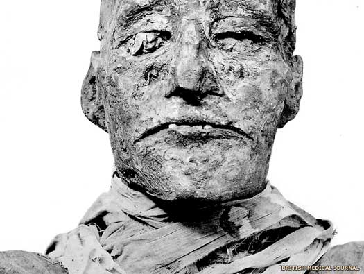 The mummy of Ramses III