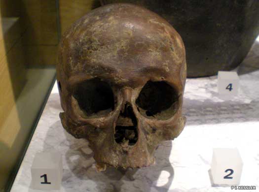 Roman-era skull from the Walbrook